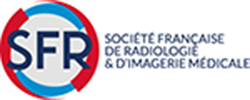 https://elsevierlogin.com/Journal-d'imagerie-diagnostique-et-interventionnelle
